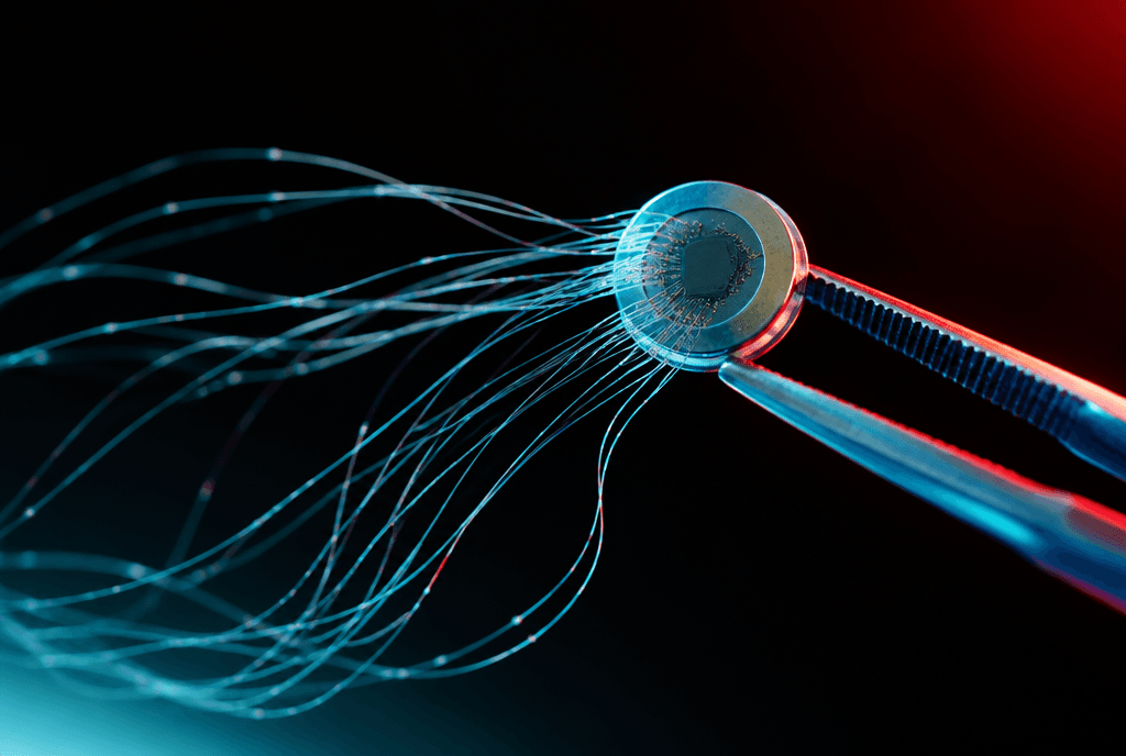 Macrofotografia di un impianto cerebrale grande come una moneta tra pinzette chirurgiche, da cui fluiscono decine di filamenti di elettrodi luminosi sottili come capelli